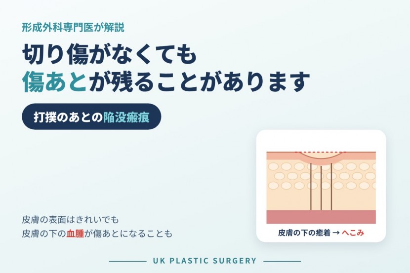 打撲のあとの陥没瘢痕